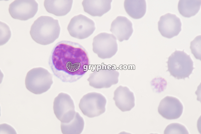 Lymphocyte x800 - gryphea.org